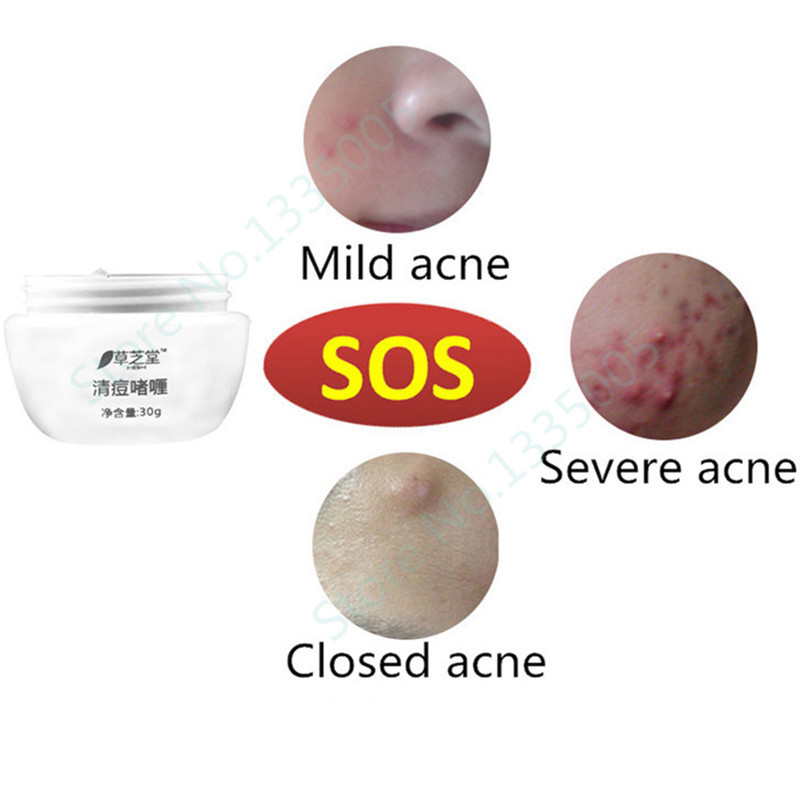 Viteks el suero contra las pecas