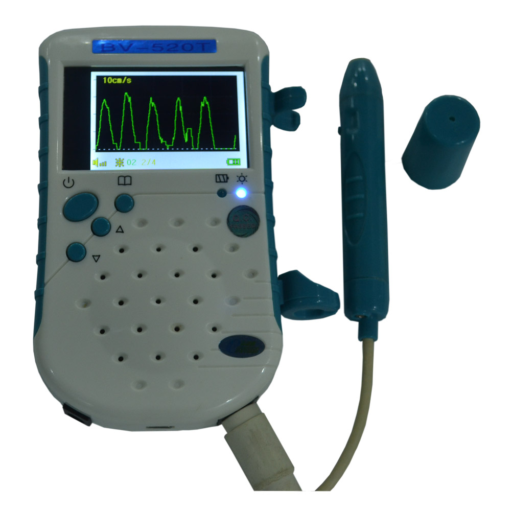 Portable unbidirection vascular doppler surgical use doppler for blood