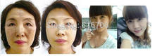 CHINESE YINNI Whitening Cream Spot Green tea anti freckle skin care whitening cream for face 2
