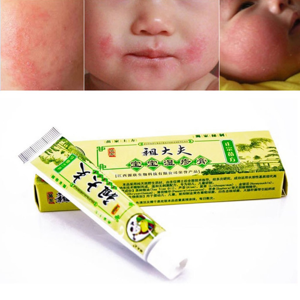 Ringworm Baby Reviews Online Shopping Ringworm Baby Reviews on