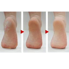 ASUN Feet File Foot Care Tool Dead Skin Peeling Removal Electric Nail File Skin Care Washable