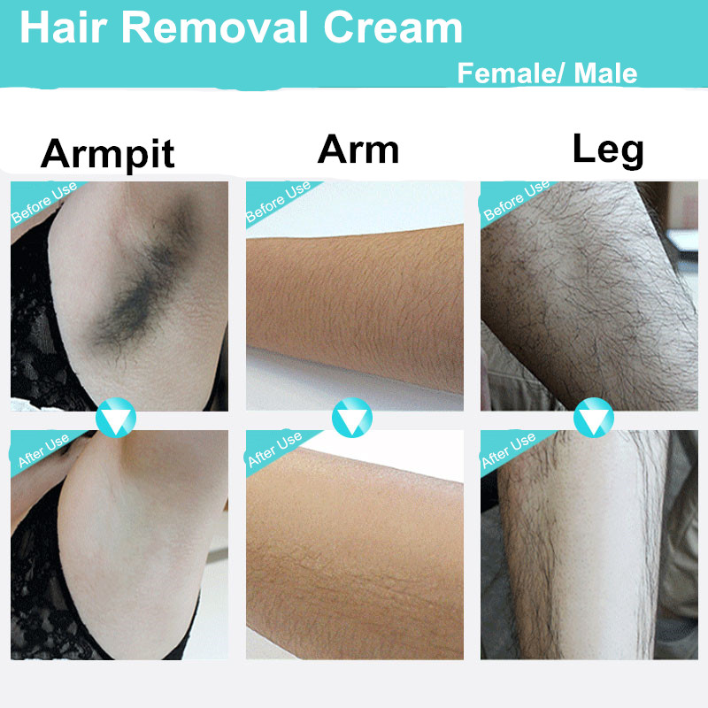 Epilatori per la rimozione dei capelli recensioni su Hand Epilatori per la rimozione dei capelli recensioni su Hand