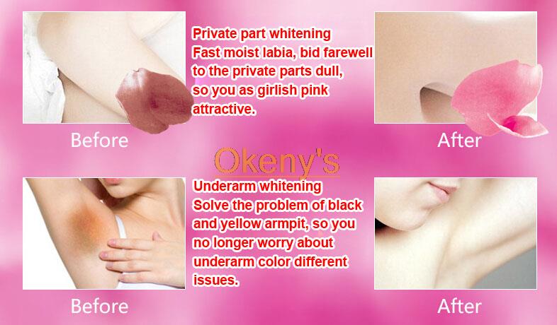Attention Keep In The Suitable Condition15c To 26c People Who Have The Skin Disease Skin Regular Skin Allergy Or Sensitive To Cherry Sakura Attention Keep In The Suitable Condition15c To 26c People Who Have The Skin Disease Skin Regular Skin Allergy Or Sensitive To Cherry Sakura