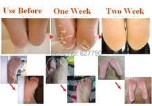 Hot 1packs Peeling Feet Mask exfoliating socks Baby Care Pedicure Socks Remove Dead Skin Cuticles Suso