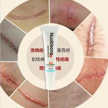 Nuobisong lanbena face anti care acne treatment cream scar removal oily skin Acne Spots skin care
