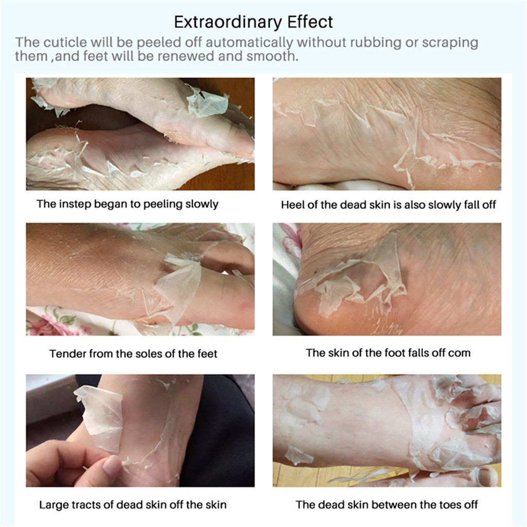 The Ultimate Guide to Crafting a Luxurious Listerine Vinegar Foot Soak for Silky Smooth Feet