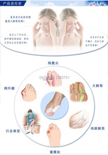 Free shipping 2014 New Hot sale Beetle crusher Bone Ectropion Toes outer Appliance Professional Technology Health