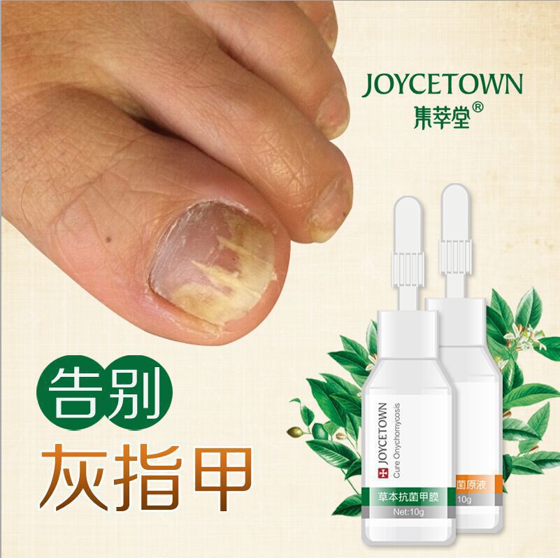Fungal Nail Treatment Essence Beauty and Foot Whitening Toe Nail Fungus Removal Feet Care Nail Gel