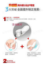 2Pairs 2014 New Hot Sale Beetle crusher Bone Ectropion Toes Outer Appliance Professional Technology Health Care