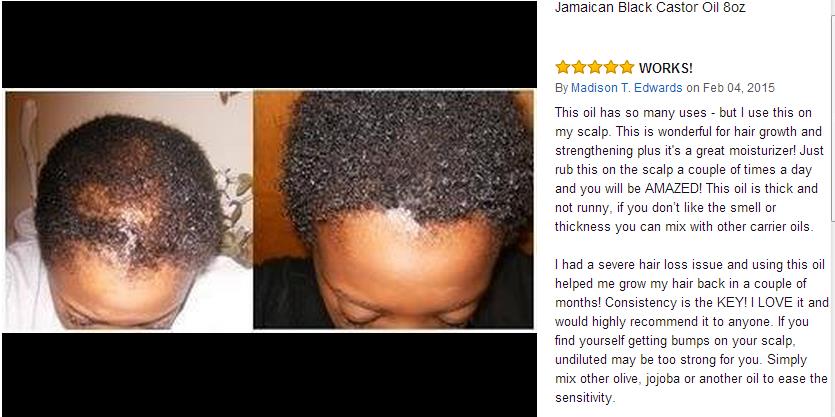 Sunny Isle Jamaican Black Castor Oil Hair Growth Oil 8oz Hair