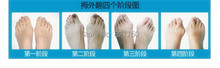 4pairs lot 2014 Hot Soft Beetle crusher Bone Ectropion Toes outer Appliance Silica Gel Toes Separation