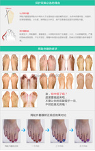 7pair 14pcs Sub toe toe braces Toe Separator Orthoses Beauty Health Braces