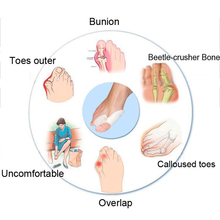 1pair Hot Soft Beetle crusher Bone Ectropion Toes outer Appliance Silica Gel Toes Separation Health Care