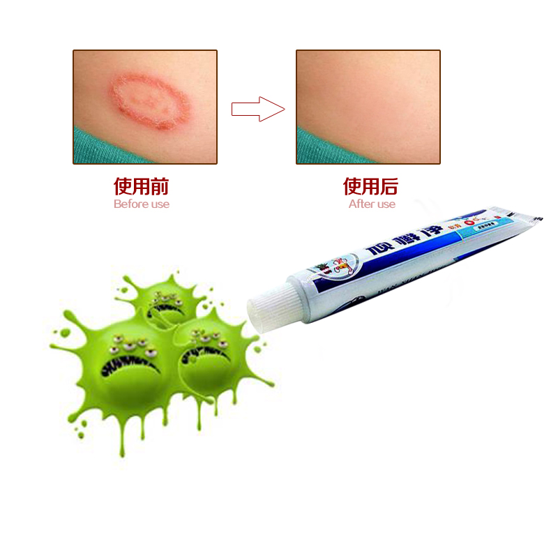 Olio di amarantovy a neurodermatitis