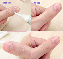 3pcs Cuticle Revitalizer Oil Pen Nail Treatment Nutritious Polish Wholesale Nail Art Repair Nutrition Nail Care
