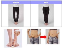 10pairs New 2014 Personal Magnetic Silicon Foot Massager Toe Ring Weight Loss Slimming Health Care