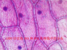 HTB1rKszKpXXXXbYXpXXq6xXFXXXc