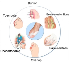 2pcs Lot Silicone Gel foot fingers Toe Separator thumb valgus protector Bunion adjuster Hallux Valgus pro