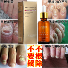 Snaz this oil after the polish to remove this black armor onychomycosis sterilization effects on a nail